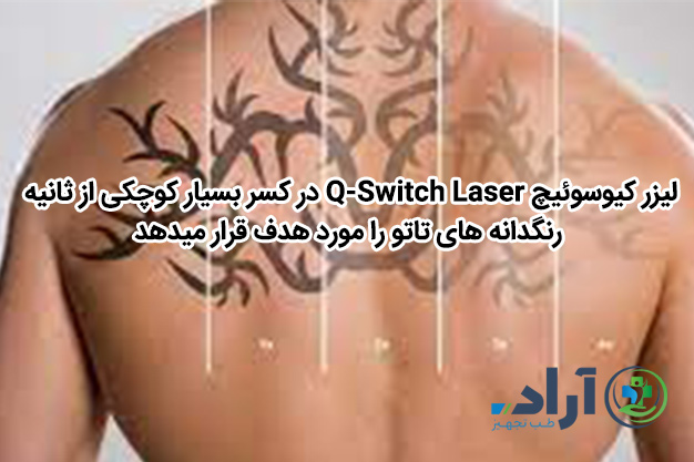 لیزر کیوسوئیچ Q-Switch Laser در کسر بسیار کوچکی از ثانیه رنگدانه های تاتو را مورد هدف قرار میدهد