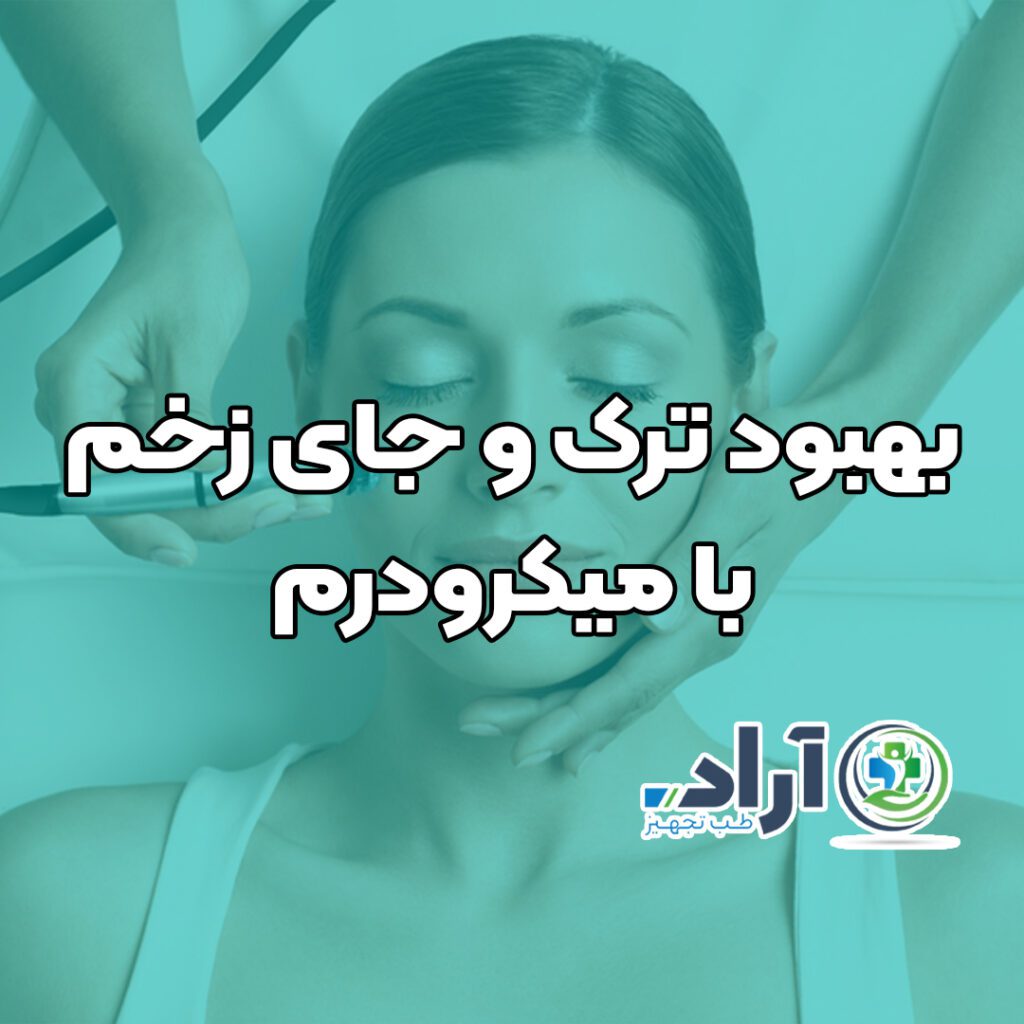 بهبود ترک و جای زخم با میکرودرم