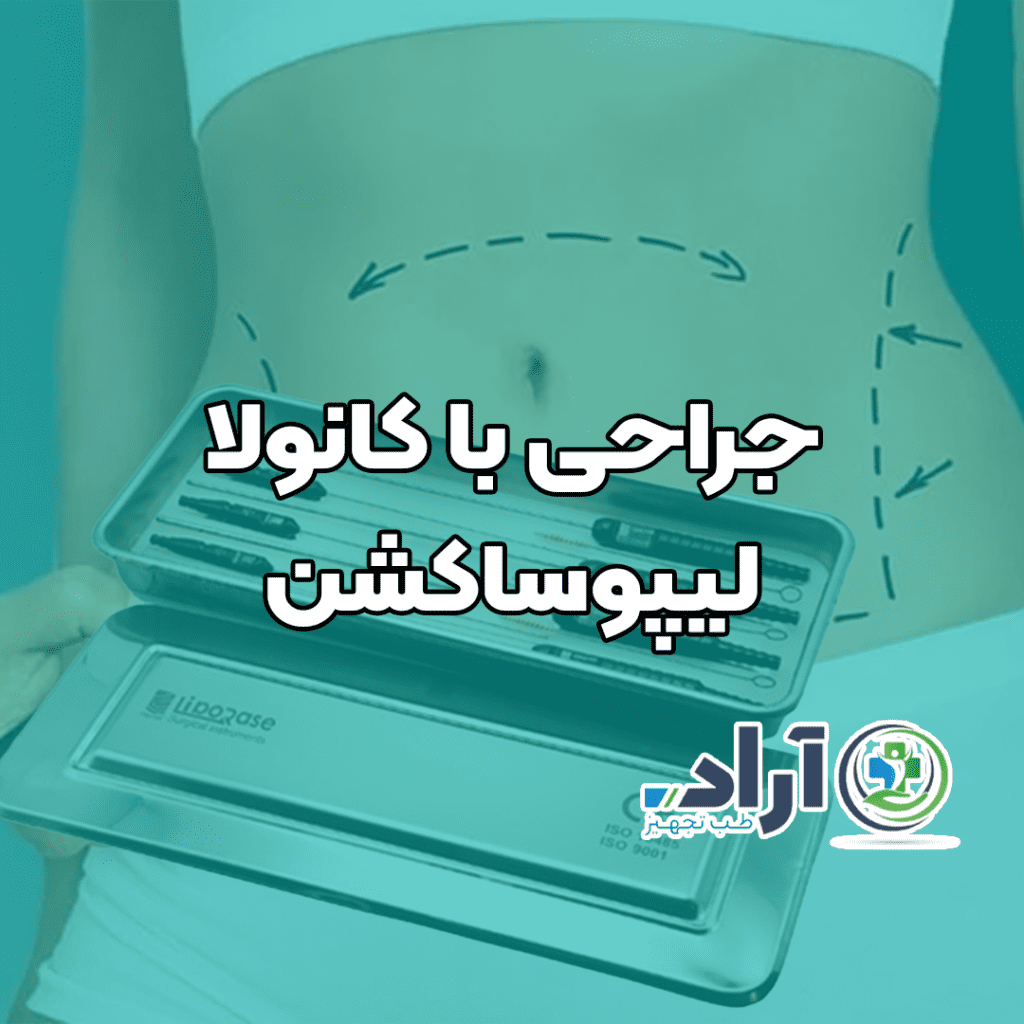 جراحی با کانولا لیپوساکشن